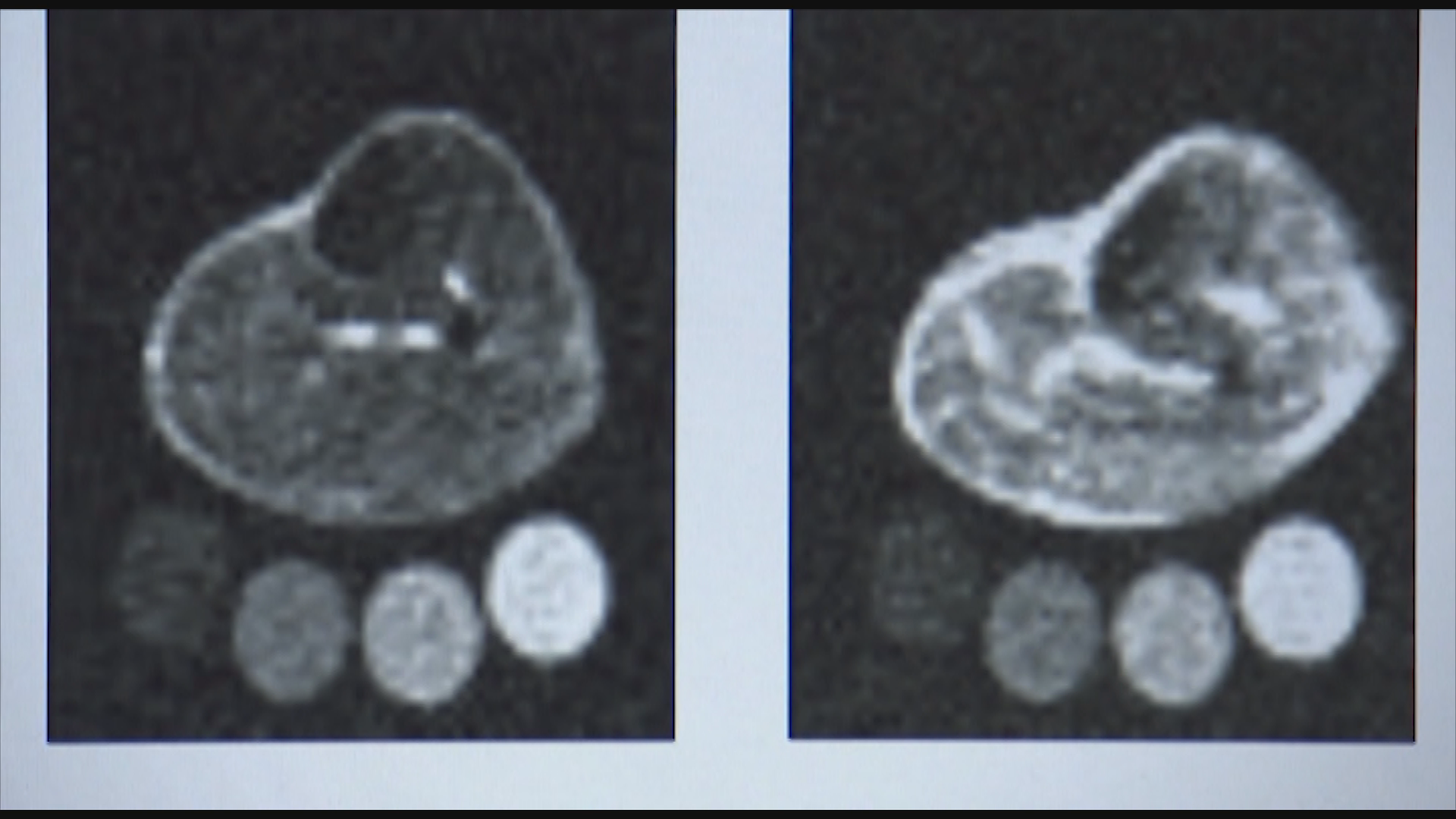 Thumbnail image for DW In Good Shape